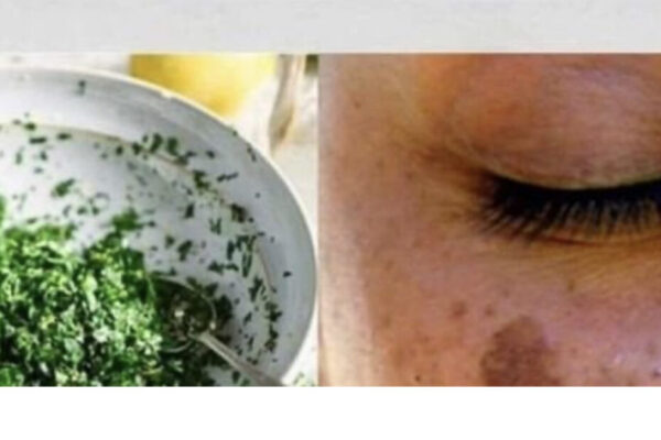 Esta planta elimina las manchas