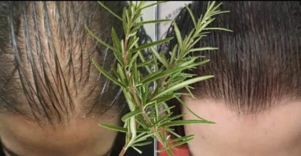 Mascarilla de romero: el secreto para acelerar el crecimiento del cabello