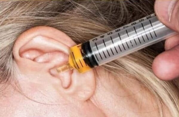 Remedios caseros efectivos para el dolor de oído