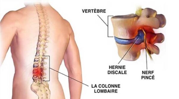 10 exercices simples qui peuvent aider à calmer des douleurs du dos