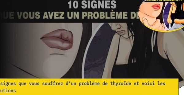 10 signes que vous souffrez d’un problème de thyroïde et voici les solutions