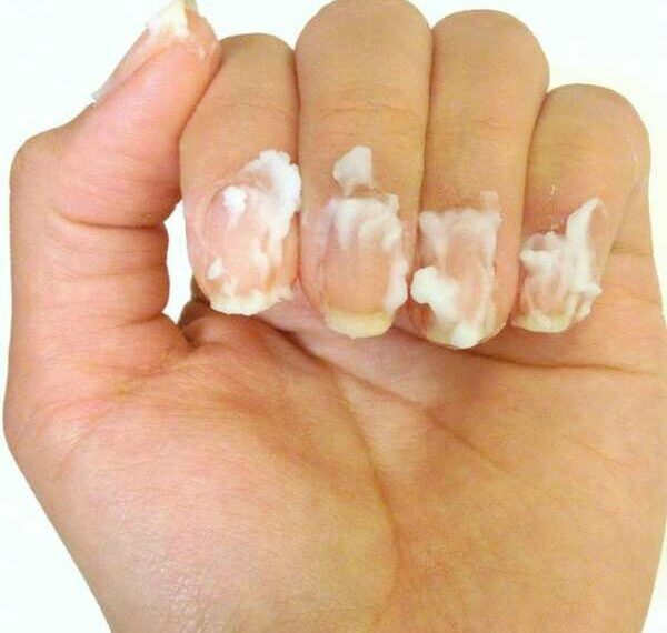 14 astuces beauté avec le bicarbonate de soude