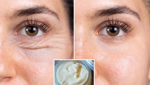 3 astuces pour éliminer les cernes et rajeunir le contour des yeux