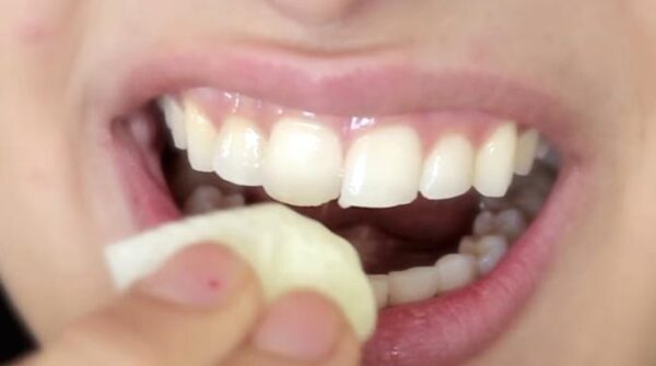 3 façons de blanchir les dents à la maison! Essayez-les pour un excellent sourire…