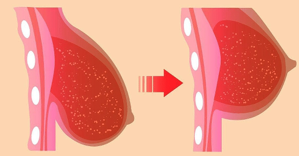 4 Exercice Efficace pour Remonter les Seins qui Tombent