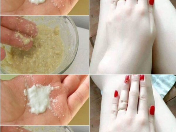 5 Masques Maison Au Bicarbonate De Soude Pour Éclaircir La Peau