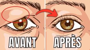 5 Remèdes Naturels Contre les Paupières Tombantes.