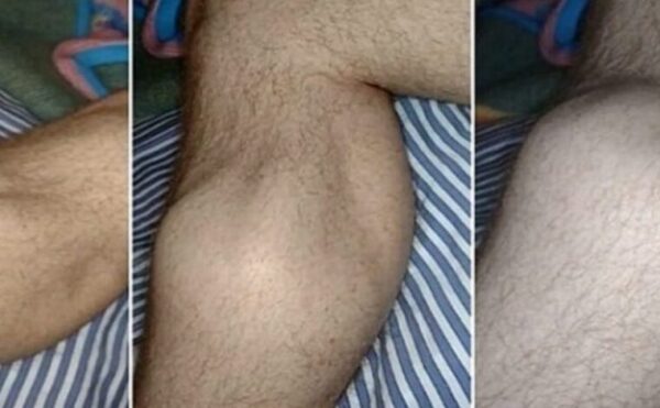 5 façons pour soulager les crampes aux jambes durant la nuit et comment les prévenir