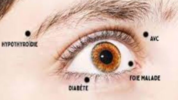 6 choses que vos yeux sont en train de vous dire sur votre santé