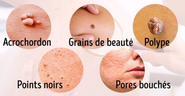 8 Maladies graves que notre peau nous signale
