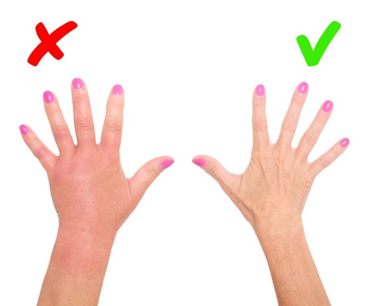 8 Maladies graves que notre peau nous signale