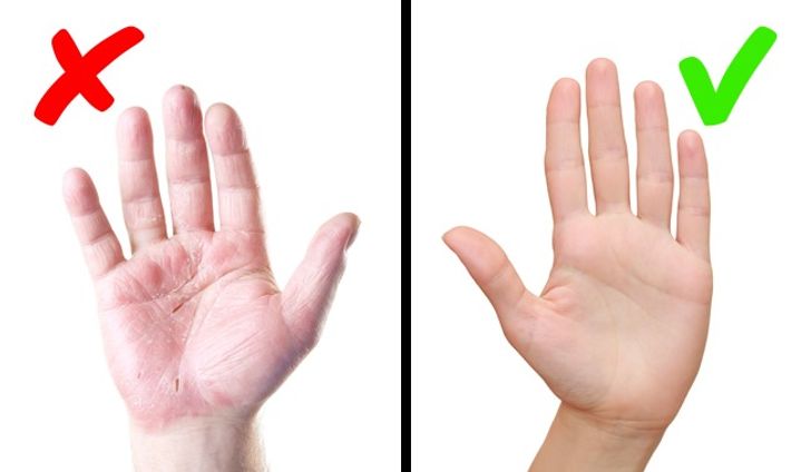 8 Maladies graves que notre peau nous signale