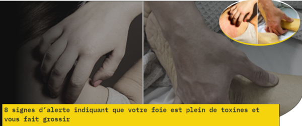 8 signes d’alerte indiquant que votre foie est plein de toxines et vous fait grossir