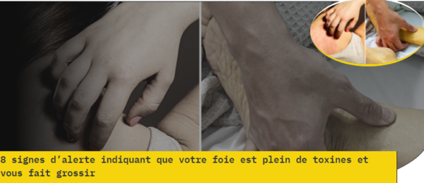 8 signes d’alerte indiquant que votre foie est plein de toxines et vous fait grossir