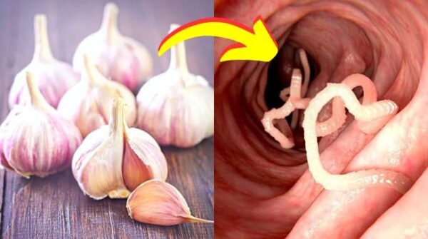 9 Remèdes de Grand-Mère Pour Éliminer les Vers Intestinaux (Rapides & Efficaces).