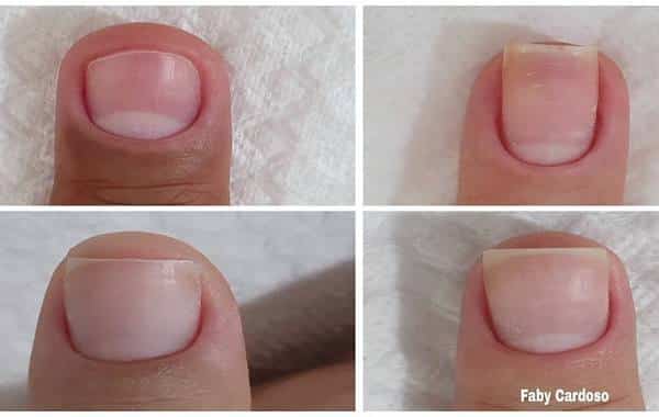 Astuce au Vinaigre de Cidre pour Renforcer et Faire Pousser les Ongles