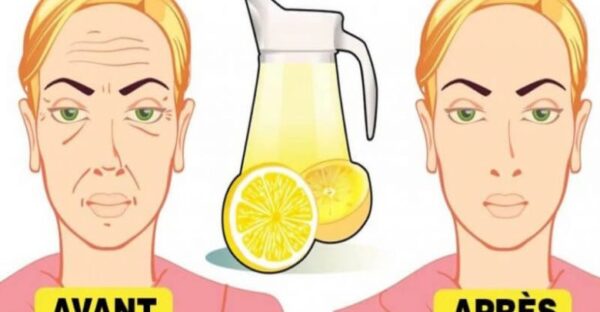 Astuce au citron pour éliminer les rides profondes du visage