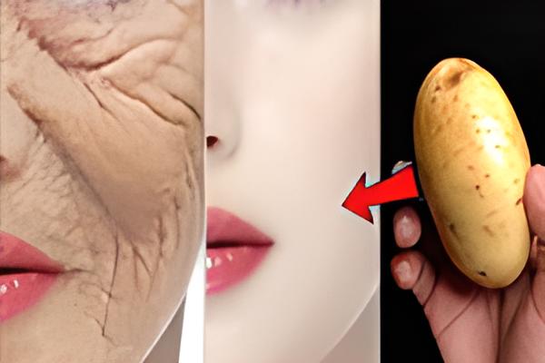 Avec Une Pomme De Terre, Une Recette Pour Éliminer Les Rides Et La Pigmentation Foncée Du Visage.