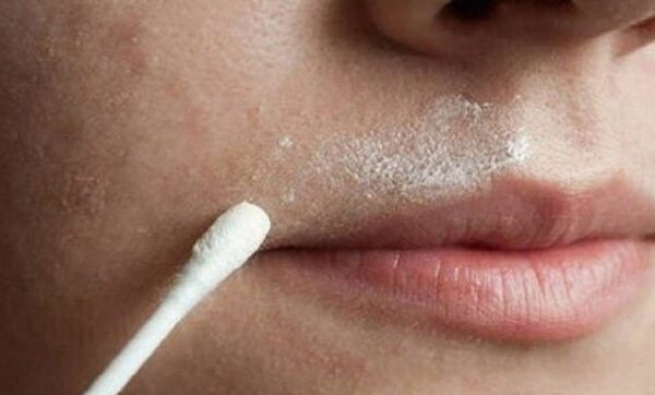 Cette recette naturelle aide à se débarrasser définitivement des poils du visage