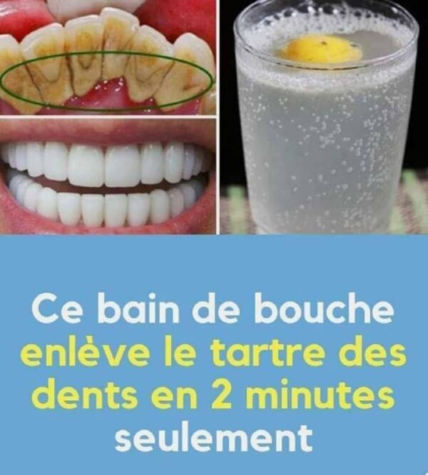 Comment Avoir des Dents Blanches : 15 Astuces Infaillibles