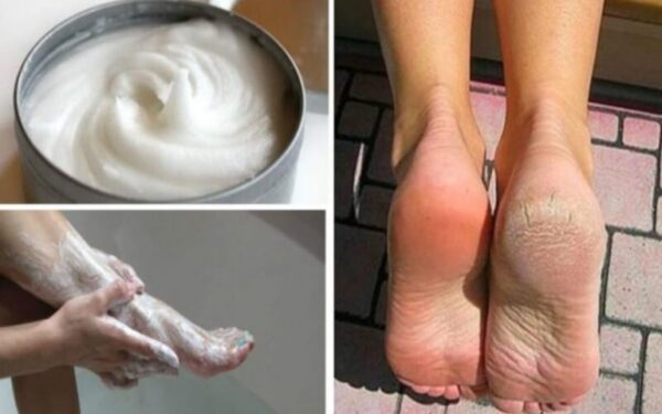 Comment faire une pédicure efficace à la maison grâce au bicarbonate de soude