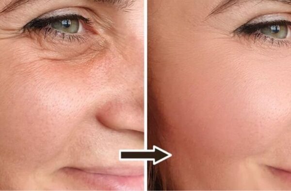 Comment préparer un gel de graines de lin qui élimine les rides et rajeunit la peau de 20 ans