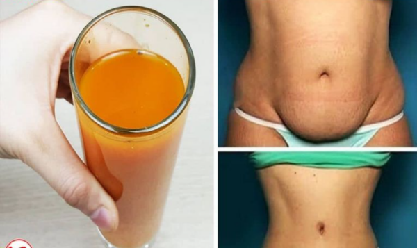 Comment vous Débarrasser d’environ 20 kg de Poison dans votre Colon