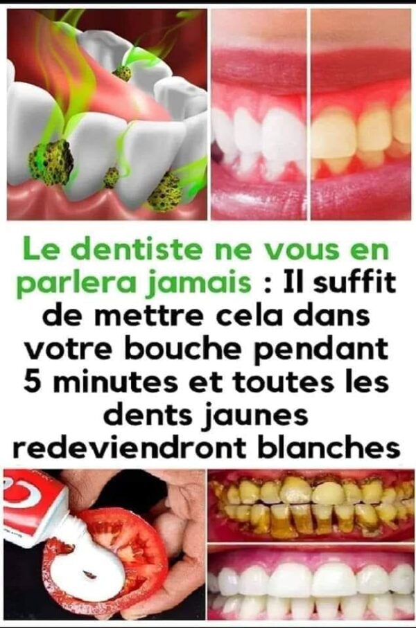 Dites adieu aux taches et à la décoloration des dents grâce au curcuma.
