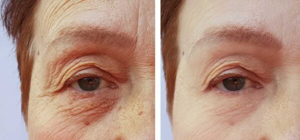 FINI LES IMPERFECTIONS ET LES RIDES SUR VOTRE VISAGE : VOUS GARDEZ LE SECRET DIRECTEMENT DANS VOTRE RÉFRIGÉRATEUR