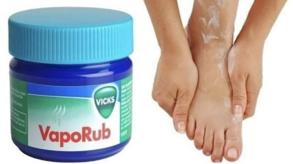 Il faudrait appliquer du Vicks Vaporub sur vos pieds