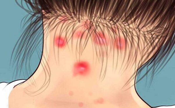 La fibromyalgie nous rend fatigués et donne des douleurs articulaires : 8 symptômes à détecter