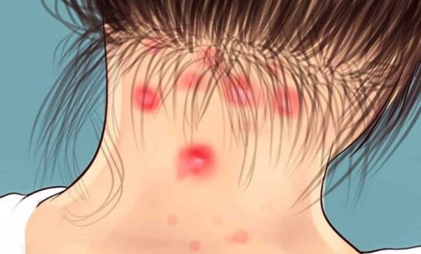 La fibromyalgie nous rend fatigués et donne des douleurs articulaires : 8 symptômes à détecter