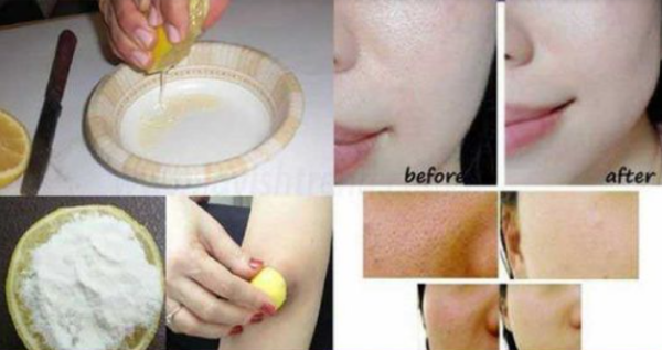 Le citron peut vous donner une peau super blanche avec ces 2 ingrédients!