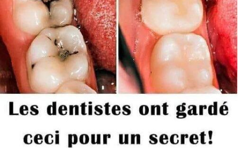 Les dentistes garde ceci secret! Ces produits éliminent les caries et les maux de dents comme un coup de magie…