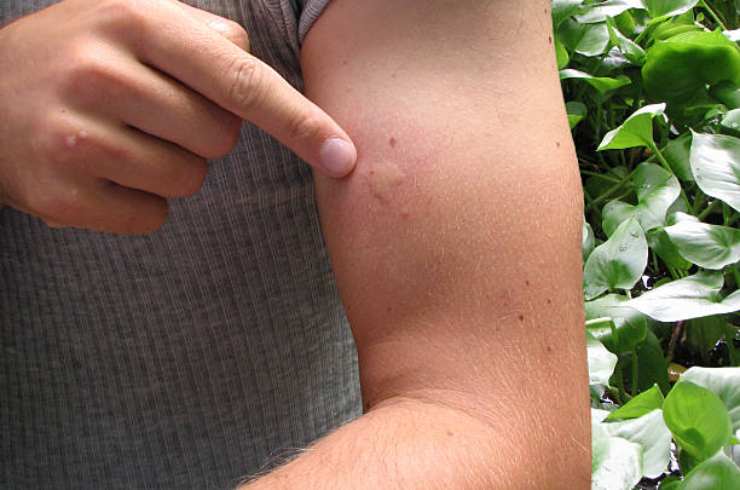 Marques de moustiques