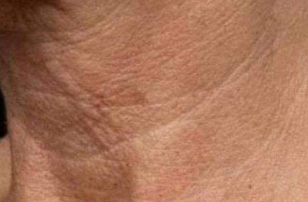 Masque maison au persil pour les rides et les imperfections