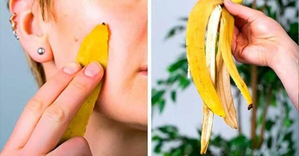 Ne jetez plus les peaux de bananes à la poubelle : voici 8 astuces intelligentes pour les réutiliser
