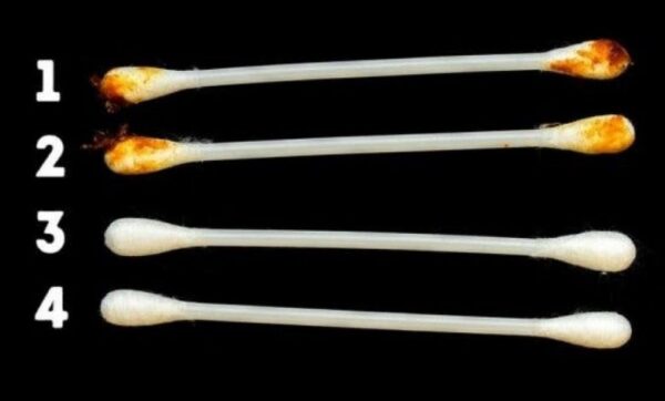 Nos oreilles révèlent notre vrai état de santé