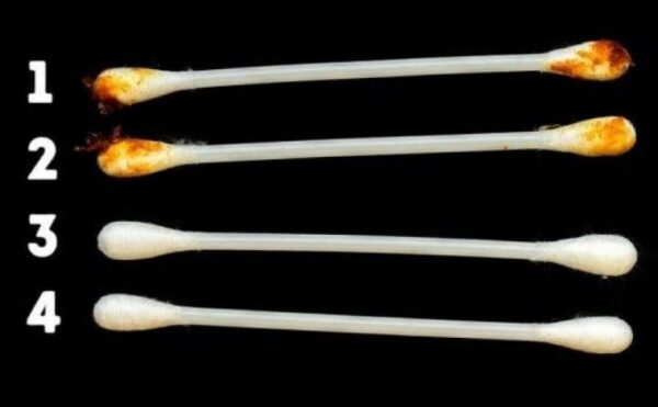 Nos oreilles révèlent notre vrai état de santé