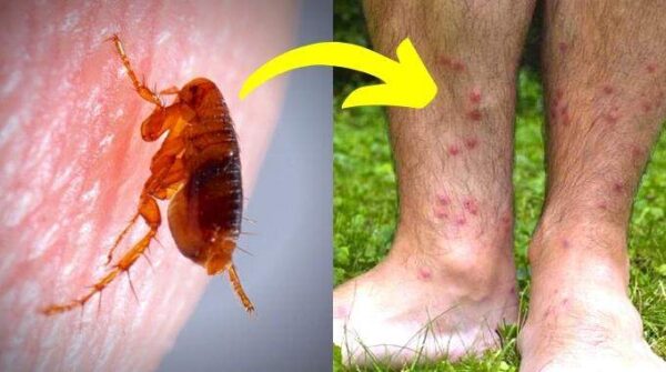 Puces de Parquet : 10 Astuces Qui Marchent Pour S’en Débarrasser Vite.