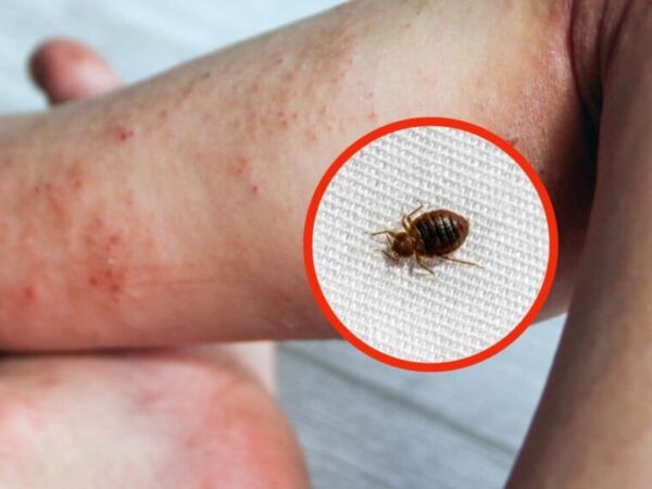 SI VOUS TROUVEZ CE SIGNE, C’EST QUE VOTRE LIT EST REMPLI DE PUNAISES DE LIT : VÉRIFIEZ RAPIDEMENT