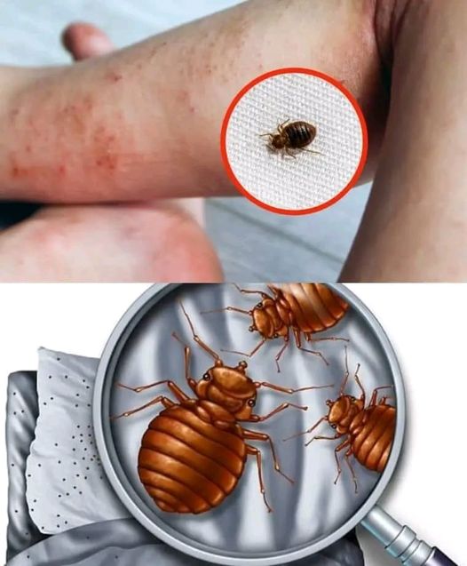 SI VOUS TROUVEZ CE SIGNE, C’EST QUE VOTRE LIT EST REMPLI DE PUNAISES DE LIT : VÉRIFIEZ RAPIDEMENT