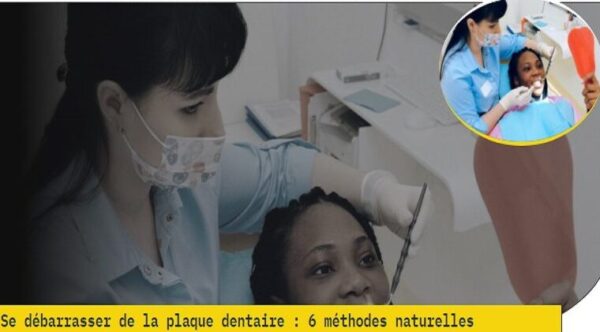 Se débarrasser de la plaque dentaire : 6 méthodes naturelles