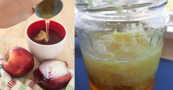 Tout ce dont vous avez besoin est de l’oignon, de l’ail, du gingembre râpé, du jus de citron et du miel pour cette recette révolutionnaire.