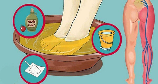 Une Méthode Simple de 10 Minutes, Pour Soulager Avec Succès la Douleur du Nerf Sciatique