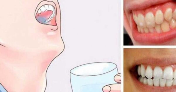 Une astuce puissante pour vous débarrasser des dents jaunes !