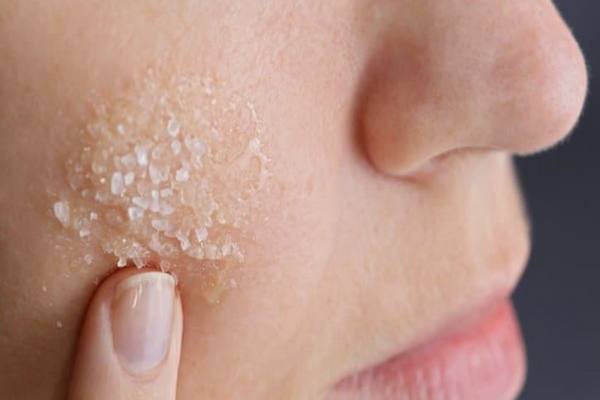 Visage : 4 Remèdes Naturels au Bicarbonate pour Lutter Contre vos Problèmes de Peau