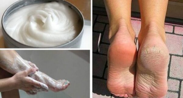 Voici comment faire une pédicure à la maison avec du bicarbonate de soude