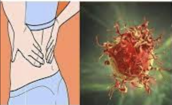 ovaires est un tueur silencieux, voici 8 signes à détecter