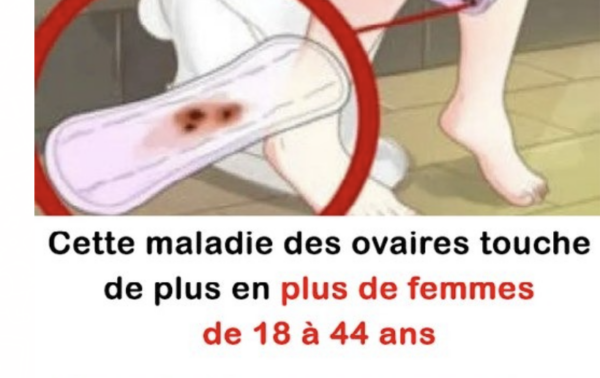 ovaires est un tueur silencieux, voici 8 signes à détecter